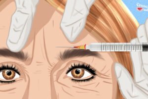 Botox Or Notox? Why I've Embraced The Needle-Free Way | CrunchyTales